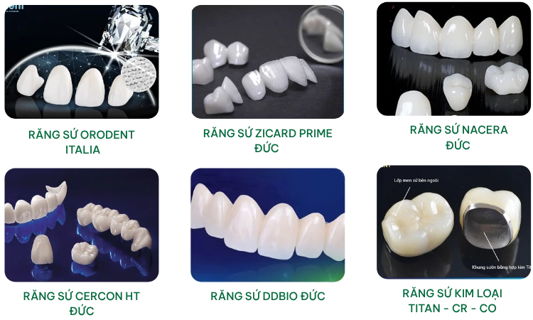 các loại răng sứ