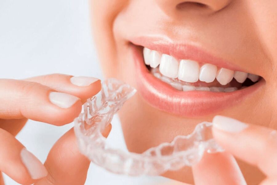 niềng răng trong suốt