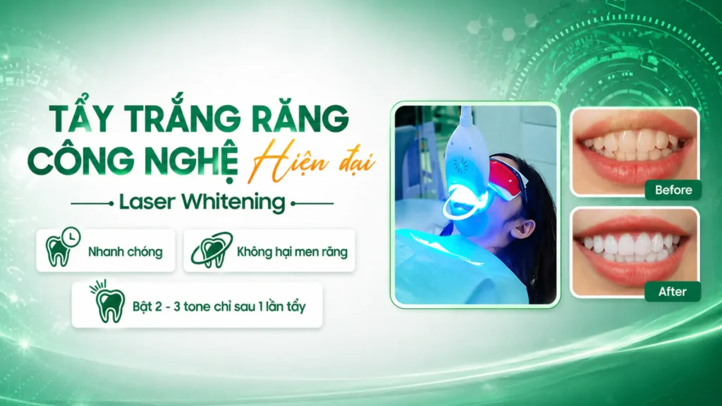 Tẩy trắng răng