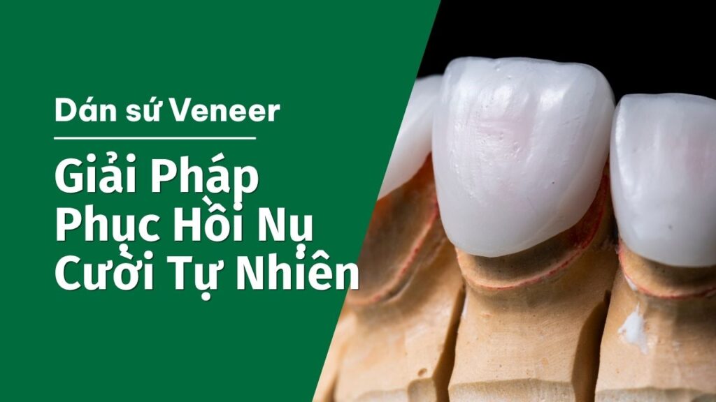 Dán Sứ Veneer Tại Tây Ninh, Giải Pháp Phục Hồi Nụ Cười Tự Nhiên