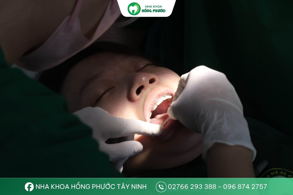 Bác sĩ Nguyễn Thị Minh Trang đang thực hiện niềng răng
