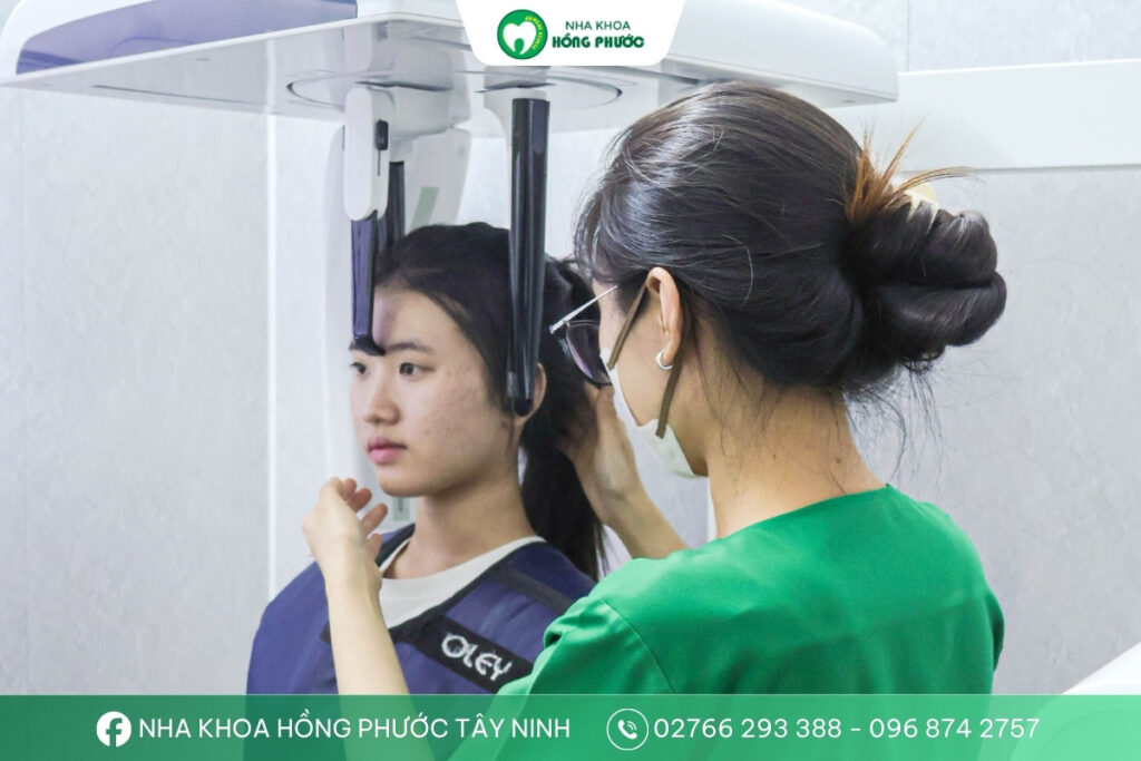 Chụp CT Cone Beam 3D để lấy dữ liệu chỉnh nha
