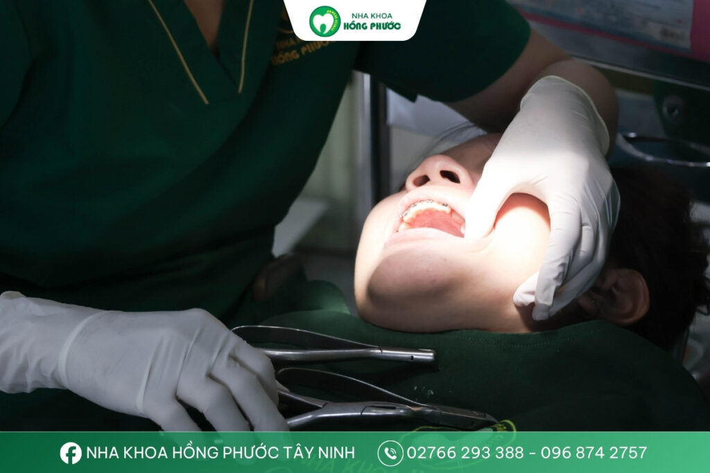 Bác sĩ Nguyễn Thị Minh Trang đang thực hiện niềng răng