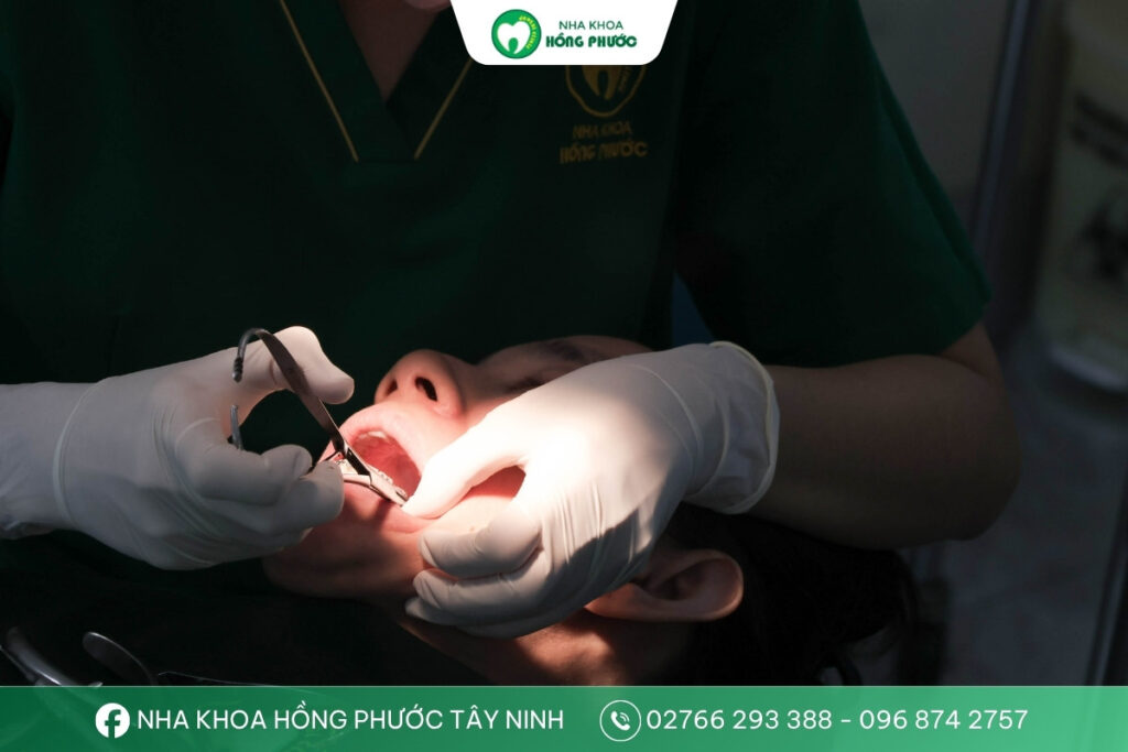 Bác sĩ Nguyễn Thị Minh Trang đang thực hiện niềng răng