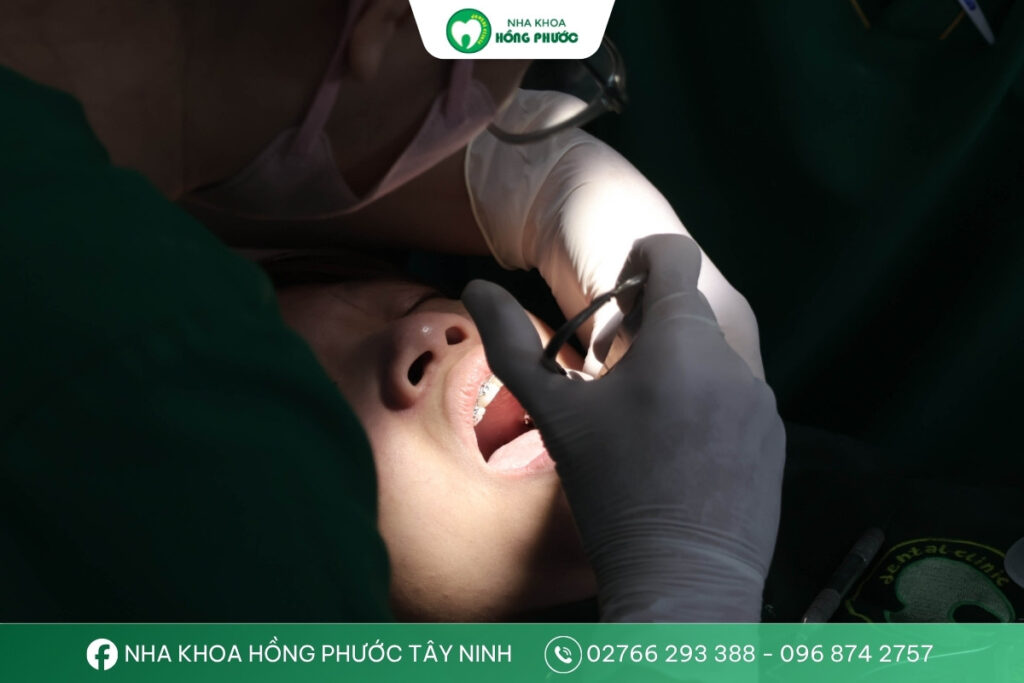 Bác sĩ Nguyễn Thị Minh Trang đang thực hiện niềng răng