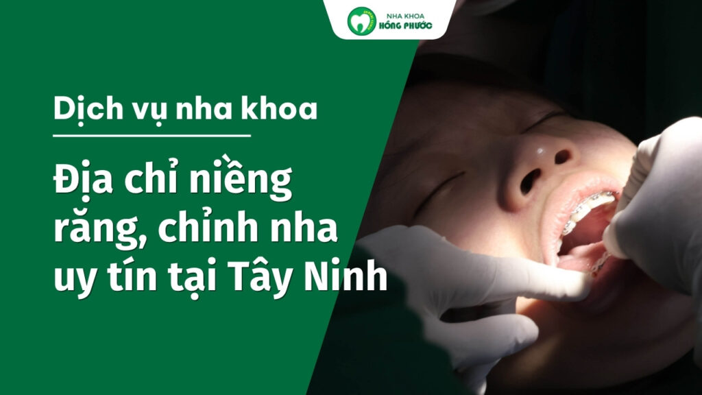 Niềng răng chỉnh nha uy tín tại Tây Ninh