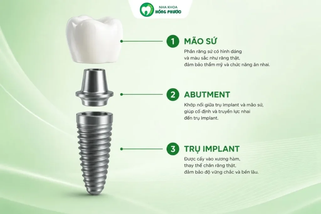 Cấu tạo của trụ Implant