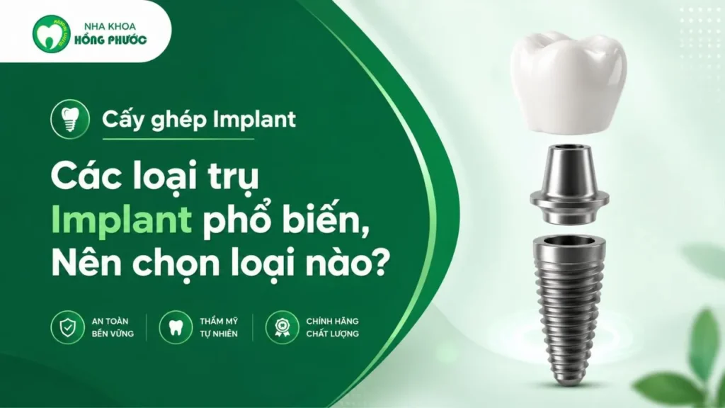 Các loại trụ Implant phổ biến