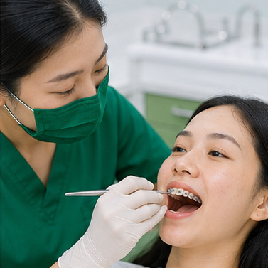 Quy trình niềng răng