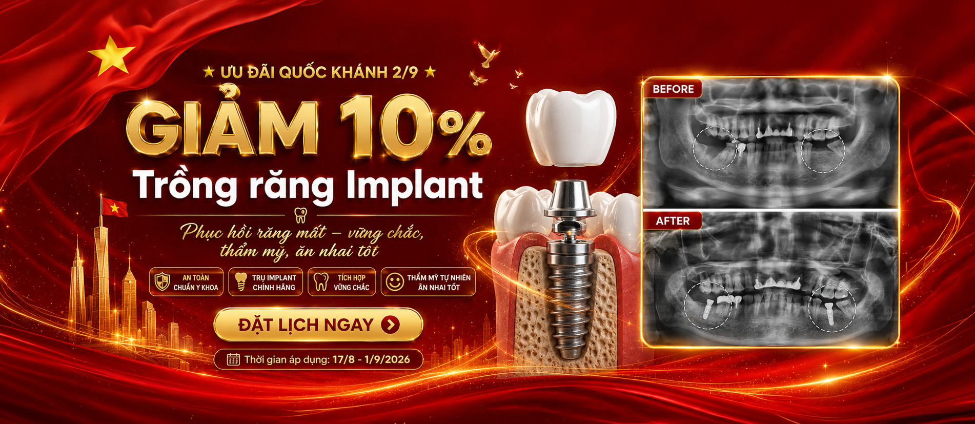 Ưu đãi nhân dịp lễ 2 tháng 9 tại nha khoa Hồng Phước