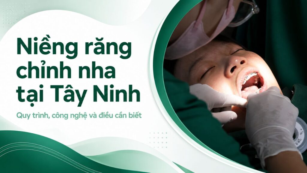 Niềng răng chỉnh nha tại Tây Ninh