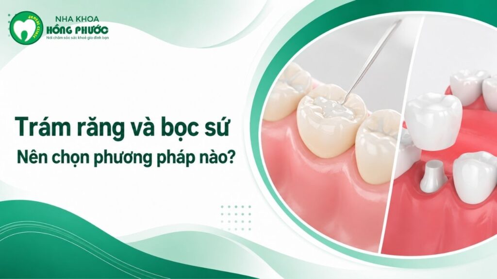 Trám răng và bọc răng sứ: nên chọn phương pháp nào