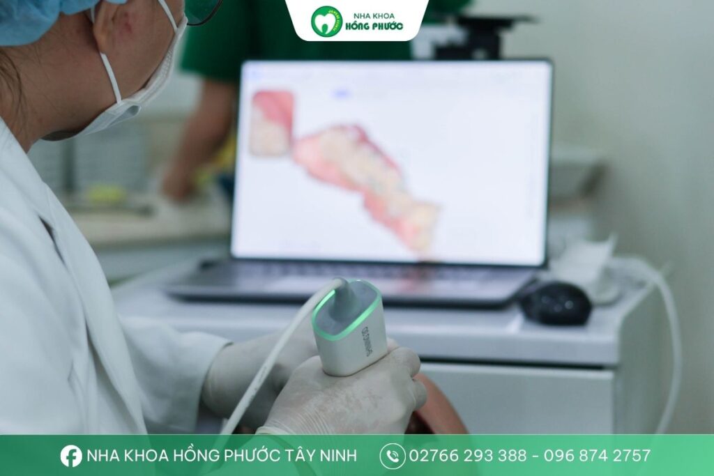 Bác sĩ thực hiện scan răng 3D để thiết kế khay niềng trong suốt tại Tây Ninh.