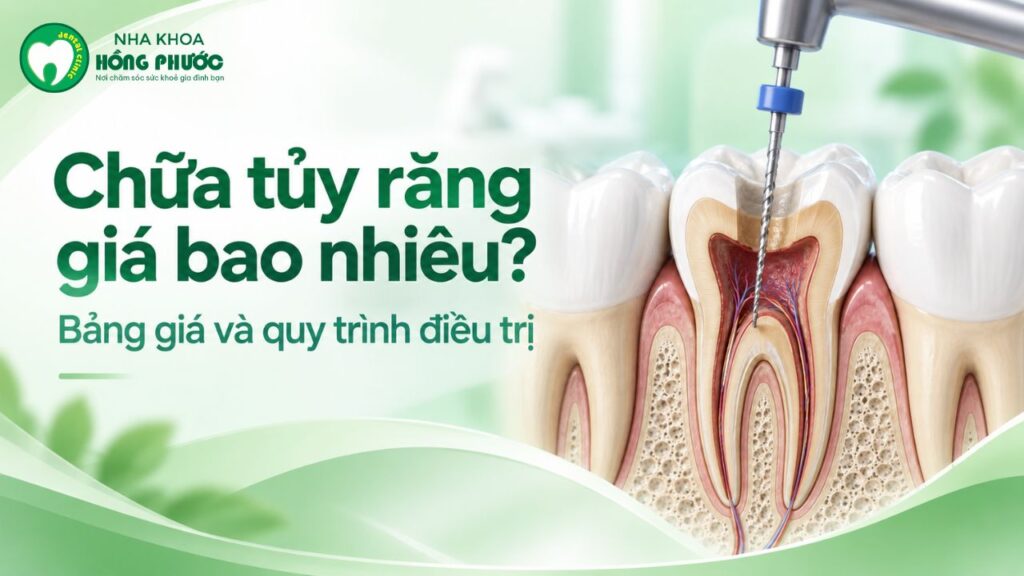 Chữa tủy răng giá bao nhiêu? Bảng giá và quy trình điều trị
