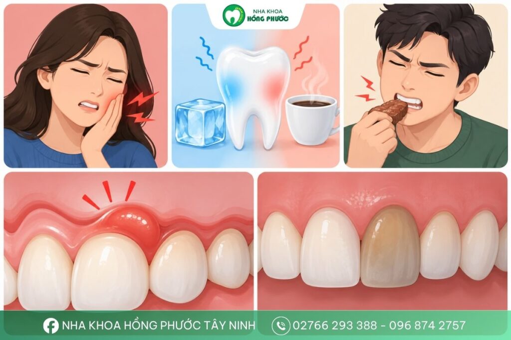 Những dấu hiệu răng có thể cần chữa tủy