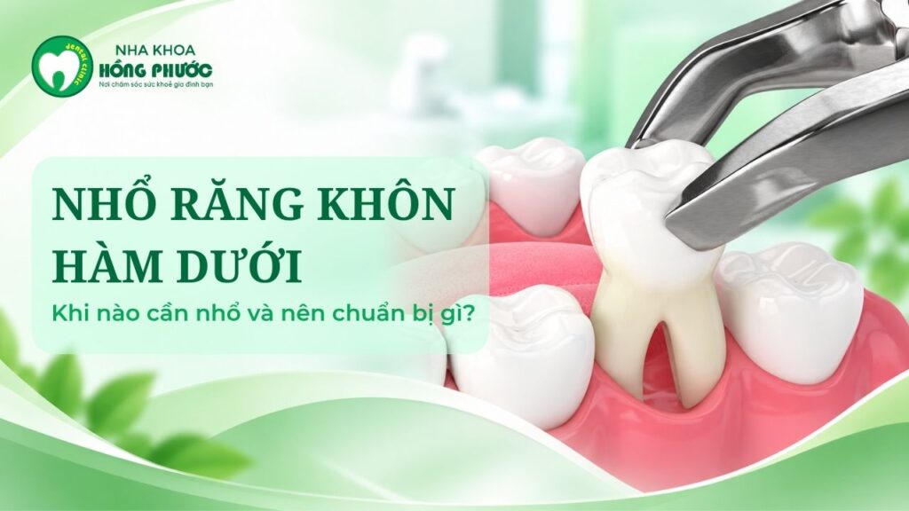 Nhổ răng khốn hàm dưới