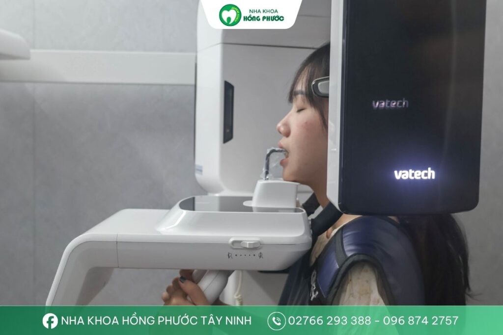 Bác sĩ sẽ yêu cầu chụp phim X-quang trước khi thăm khám